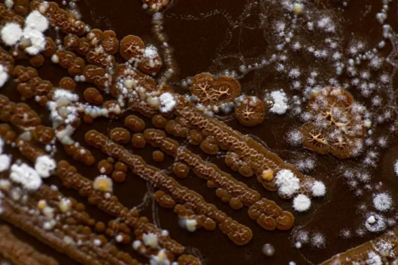 Close-up of fungus balls among white mycelium strands in soil.