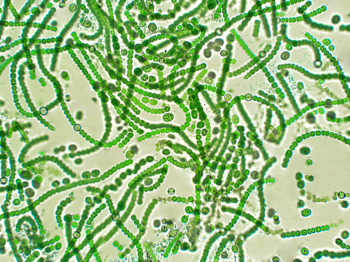 how to get rid of nostoc algae